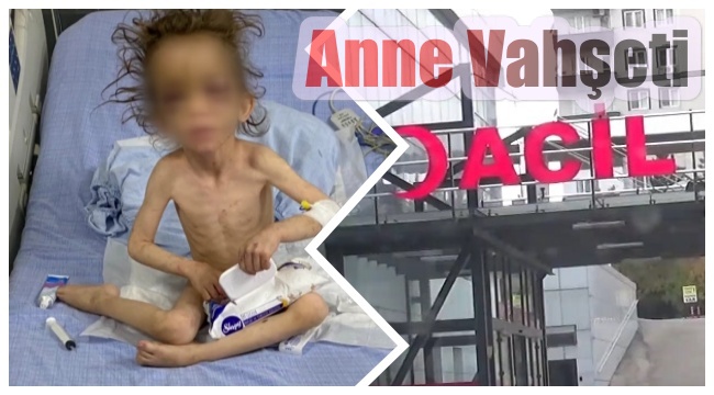 Böyle anne olmaz olsun.! 5 yaşındaki çocuğuna aç bırakıp günlerce işkence etti...